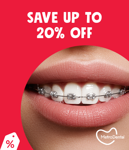 Metro Dental: 20% OFF