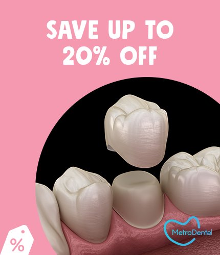 Metro Dental: 20% OFF